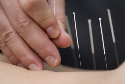 {756F7807-B33C-43A4-8375-8BD1D7A59770}_medicina-alternativa-acupuntura-bom-retiro {756F7807-B33C-43A4-8375-8BD1D7A59770}_medicina-alternativa-acupuntura-bom-retiro